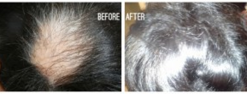 Before And After Hair1 300x111